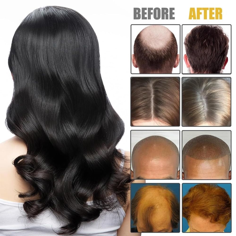 Nieuwe Nourishes Hair Roots Vo - Hair Care Formulation recensie en prijs