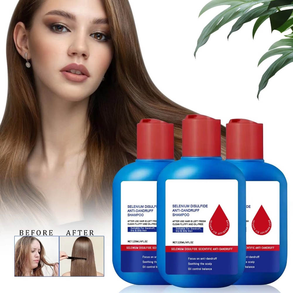 Nieuwe 120ml Nipori Shampoo Oi - Hair Care Dandruff recensie en prijs