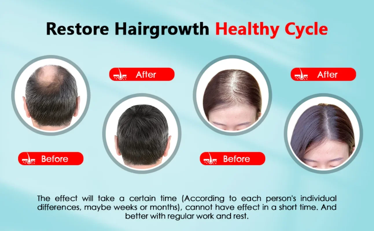 Haargroei Cap Oplaadbare 2000m - Hair Care Vegan recensie en prijs